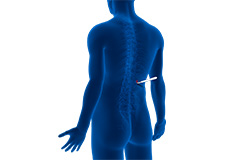 Minimally Invasive Spine Surgery